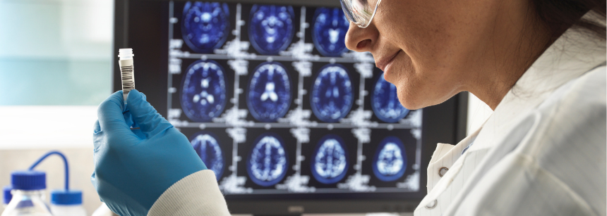 Non solo Alzheimer: cure personalizzate e nuove prospettive per le demenze