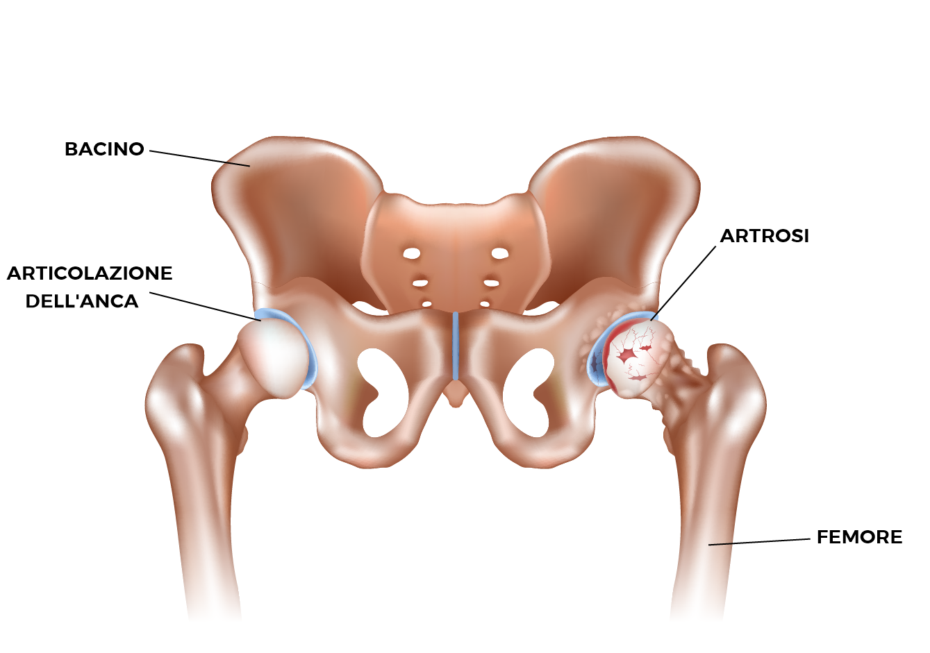 Articolazione coxo-femorale